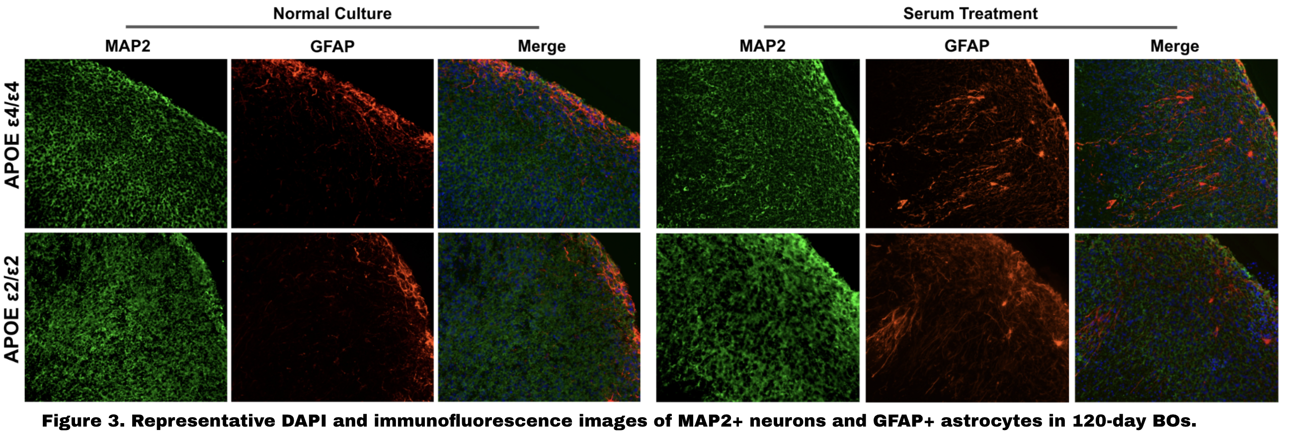 Figure 1: MAP2 and GFAP immunofluorescence in APOE ε2 and ε4 organoids