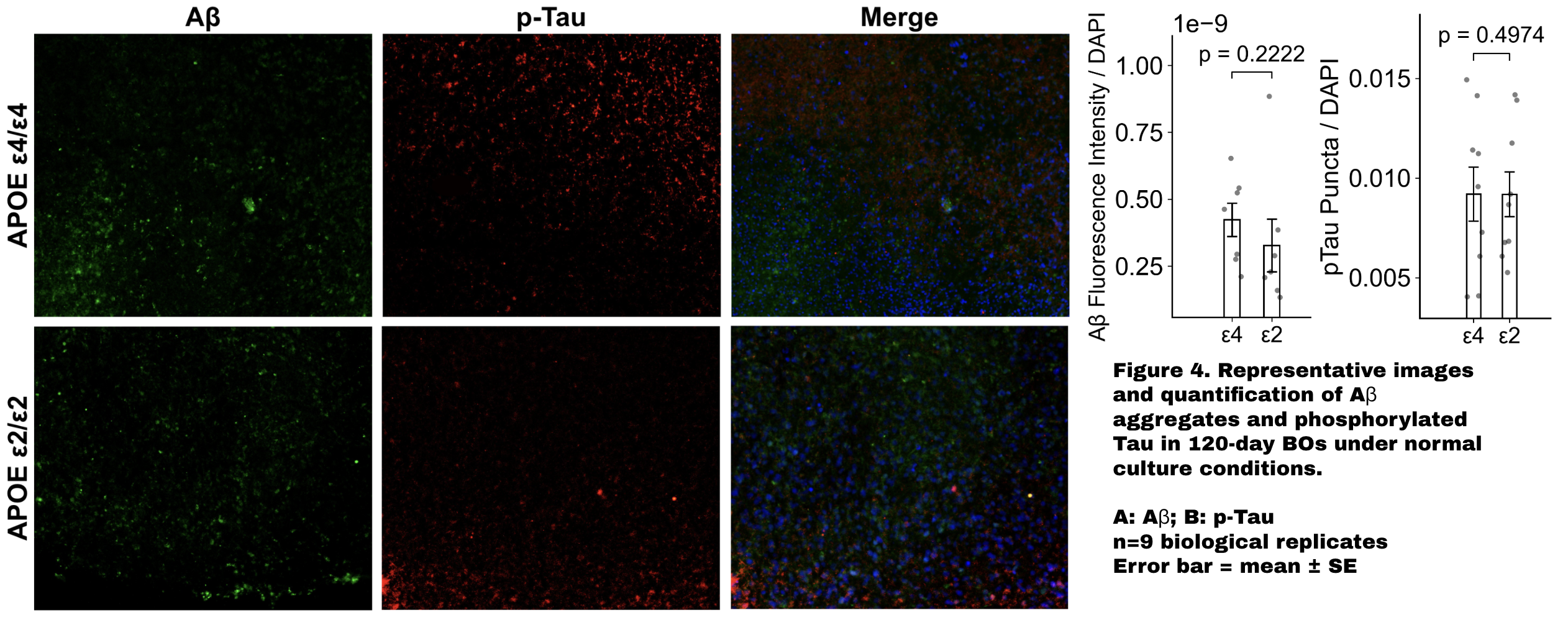 Figure 2: Aβ and p-Tau in serum-minus conditions