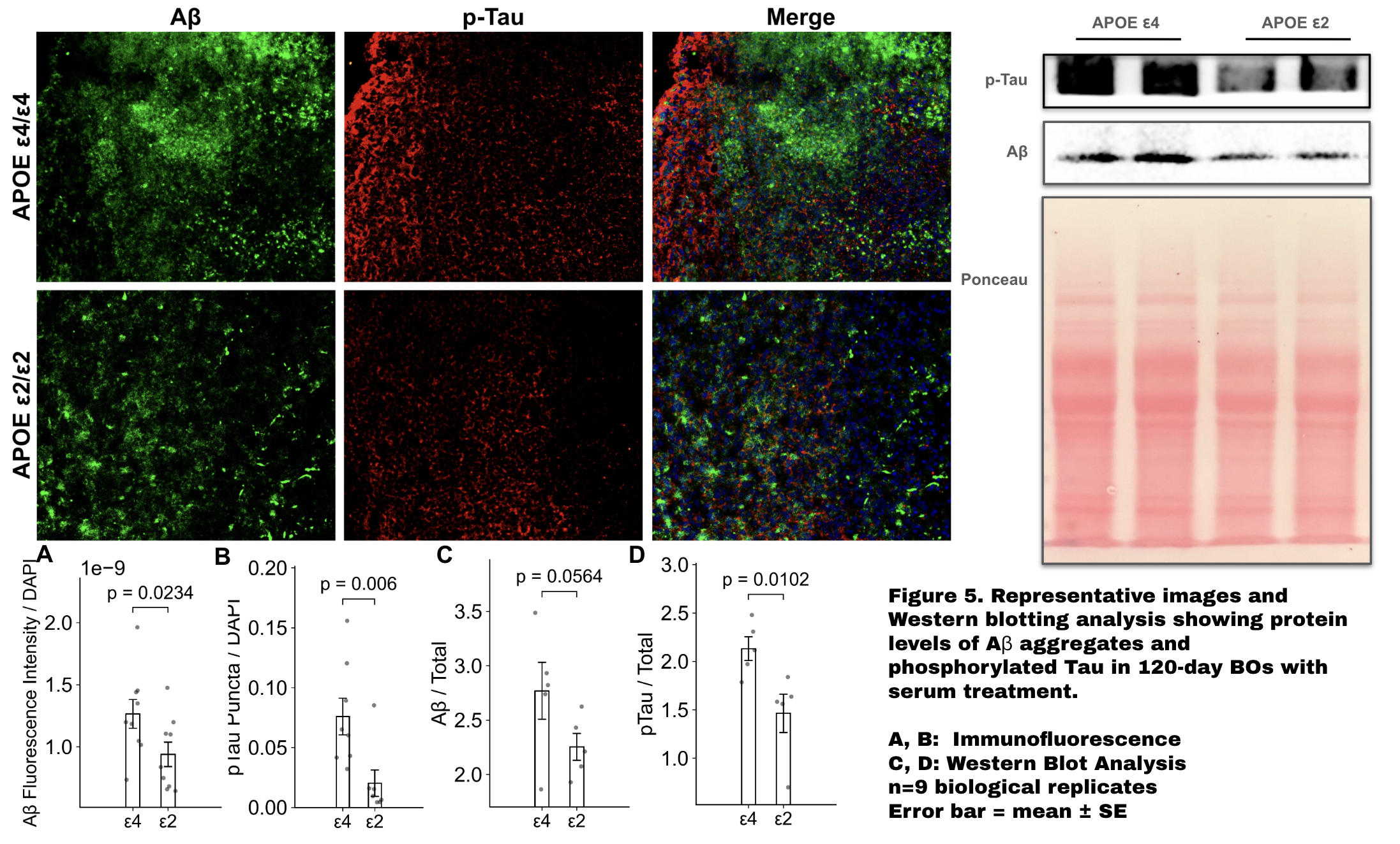 Figure 3: Aβ and p-Tau with serum treatment plus Western blot